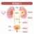人間の身体★泌尿器★尿路結石★文字あり