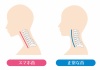 人間の身体★首★正常な頚椎とストレートネック★スマホ首
