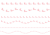 7_ライン_跳ねるウサギ・ピンク